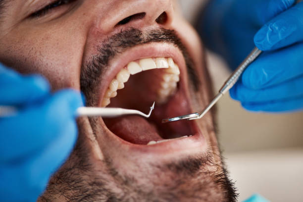 Best Emergency Broken Tooth Repair in Holt, AL